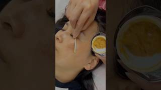 Pigmentation solution free at home shorts pigmentation skincondition diy viral youtube [upl. by Knowles]