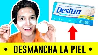 DESMANCHAR LA PIEL CON ÓXIDO DE ZINC REMEDIO CASERO DESITIN  ACNE  CICATRICES  AndyZaturno [upl. by Anihsat849]