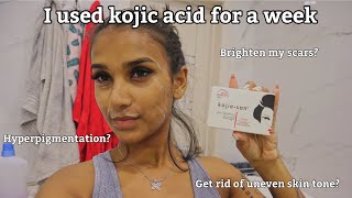 I Used Kojic Acid For A Week amp This Happened  Kojie San Review [upl. by Atlante699]