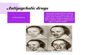 Psychopharmacological treatment [upl. by Schaper450]