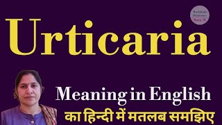 urticaria meaning l meaning of urticaria l urticaria ka matlab Hindi mein kya hota hai l vocabulary [upl. by Nawotna661]