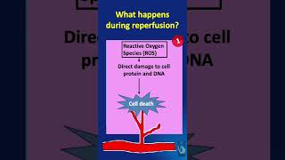 Shorts  119 IschemiaReperfusion Injury IRI  What happens during the reperfusion phase [upl. by Cuthburt]