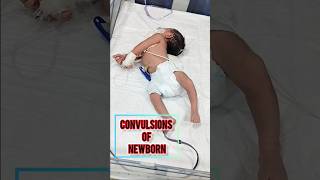 Convulsions Of Newly Bron Baby  ytshorts shorts youtubeshorts trending viralvideo cute [upl. by Ahsetan]