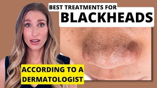 Blackheads Dermatologist Shares Best Treatments to Remove Them with Affordable Skincare Options [upl. by Telimay459]