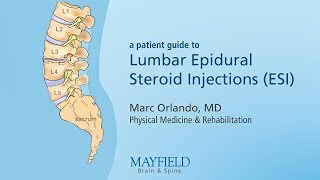 Lumbar Epidural Steroid Injections [upl. by Ycnalc]