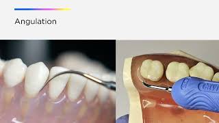 Optimize your Cavitron® Ultrasonic Technology The Three A’s of Ultrasonic Instrumentation [upl. by Kcirdahs711]