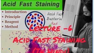 AFB Acid Fast Staining for MTuberculosis Bacillus staining medical viralvideoyoutube [upl. by Ognimod207]