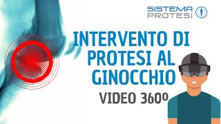 🔴 INTERVENTO PROTESI del GINOCCHIO ▷▷ VIDEO A 360º [upl. by Kellia]