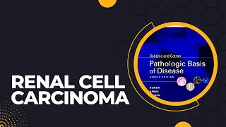 Renal cell carcinoma  Risk factors  Pathogenesis  Morphology  Clinical features [upl. by Nitsyrc]