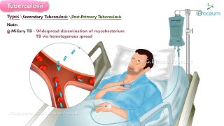 Tuberculosis🫁🦠  Microbiology  Clinical features  Diagnosis  Treatment [upl. by Stanwood783]