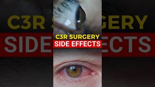 C3R Surgery Side Effects [upl. by Sulamith802]