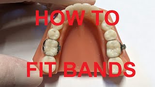 How to fit bands on teeth [upl. by Intirb]