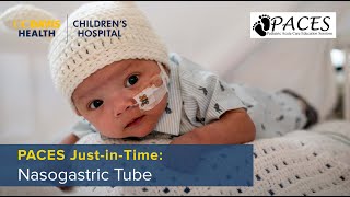 PACES JustinTime Nasogastric Tubes [upl. by Bowles]