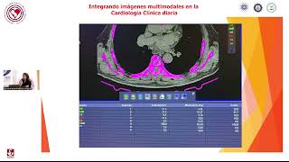 Reunión Científica Mensual Integrando Imágenes multimodales en la Cardiología diaria [upl. by Idur441]