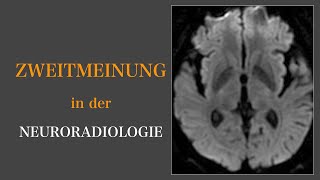 Zweitmeinung in der Neuroradiologie I Hashimoto I MS I Mikroangiopathie I Brain and Synapse [upl. by Ridinger]