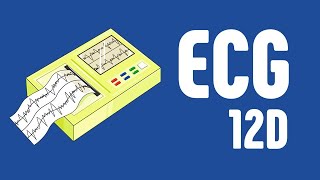 Électrocardiogramme 12 dérivations  ECG 12 D [upl. by Seppala462]