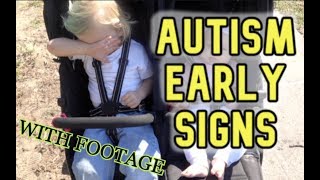 AUTISM EARLY SIGNS  Two Years Old Incl Footage [upl. by Goldi]