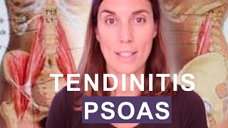 Tendinitis de psoas ilíaco o psoitis  Síntomas cómo distinguirlo de la artrosis y tratamiento [upl. by Means]