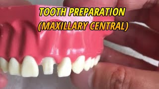 CROWN PREPARATION TUTORIAL MAXILLARY CENTRAL [upl. by Linson273]