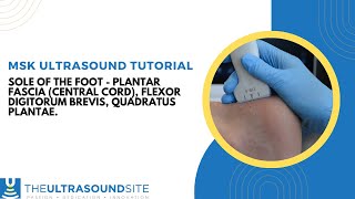 MSK ultrasound of the plantar foot [upl. by Goda]