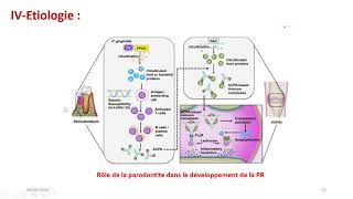 La polyarthrite rhumatoide [upl. by Sarena]