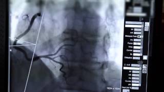 A Stent in Time Saves Lives [upl. by Auop311]