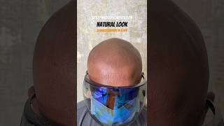 Scalp micropigmentation brings back your confidence scalpmicropigmentation smp [upl. by Einneg]