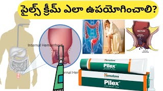 How to Use Piles Ointment in Telugu [upl. by Scrope]