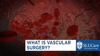 What is Vascular Surgery [upl. by Dnarb]