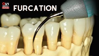 FURCATION The anatomic area of a multirooted tooth where the roots diverge [upl. by Bal]