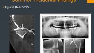 Carestream Dental CBCT in Orthodontics [upl. by Mulvihill]