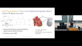 Lecture 13  Pacemaker Basics PoMCPS [upl. by Mirilla447]