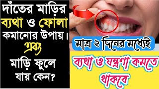 দাঁতের ও মাড়ি ফোলার ঔষধ  dater betha komanor upay 💯 সমাধান Tooth amp Gum Swelling Solution [upl. by Ruffi]