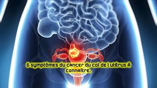 6 symptômes du cancer du col de l’utérus à connaître [upl. by Eelik575]