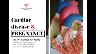 Cardiac disease amp pregnancy by Dr Samer Ahmeed [upl. by Orenid]