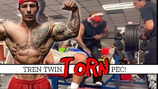 Hate To Say I Told You So  Tren Twins Mikey Torn Pec [upl. by Mallis]