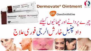 clobenate gm cream uses  price  composition  dose  side effects  review  in hindi [upl. by Neelie]