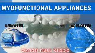 MYOFUNCTIONAL APPLIANCES  ACTIVATOR  BIONATOR myofunctionalappliances orthodontics [upl. by Ardnua459]