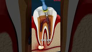 What Is A Root Canal 😳facts shorts youtubeshortsshortsvideo reels [upl. by Herwig890]