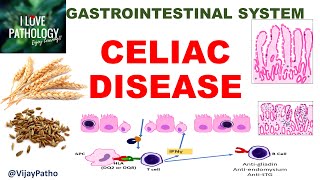 Celiac disease Etiopathogenesis Morphology amp Clinical features GIPath ilovepathology [upl. by Burns]