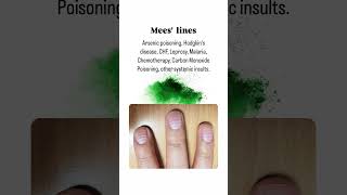 Common Nail Diseases You Should Know About NailHealthNailCareFungalInfectionNailPsoriasis [upl. by Morita]