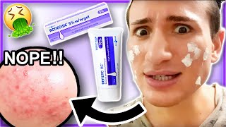 How to use PanOxyl 10 Benzoyl Peroxide Acne Foaming Wash [upl. by Notled948]