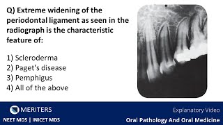 NEET MDS  INICET  OPM  Skin And Vesiculobullous Lesions  Explanatory Video  MERITERS [upl. by O'Connell742]