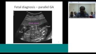 dTGA diagnosis and preoperative assessment by Dr Sivakumar [upl. by Cordelia945]