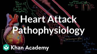 Heart attack myocardial infarction pathophysiology  NCLEXRN  Khan Academy [upl. by Lecram]