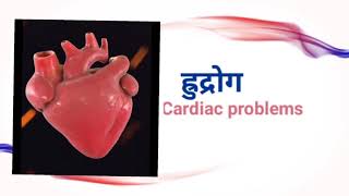 Hrudroga  Cardiac disease of Ayurveda  BAMS  Ayurveda  Roganidana  Vikruti vijnana [upl. by Ainocal]