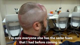 Patient IMMEDIATELY following an ARTAS robotic hair transplant talks about what it was like [upl. by Baptist]