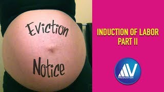 Induction Of Labor Part II [upl. by Anilev]