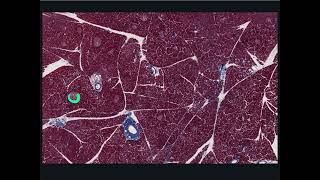 Endocrine System Histology  Endocrine Pancreas [upl. by Jolenta547]