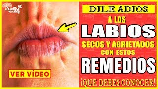 Como Quitar Los Labios Secos Y Agrietados Con Estos Remedios Caseros [upl. by Sheryle]